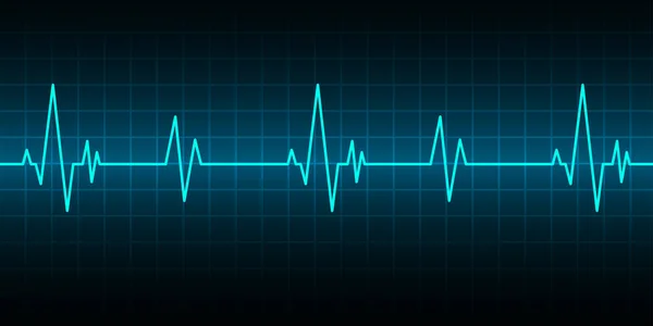 ecg